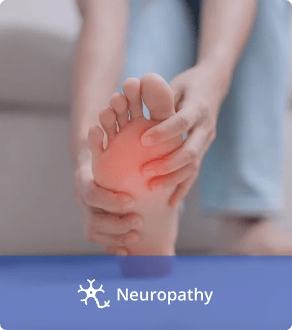 neuropathy